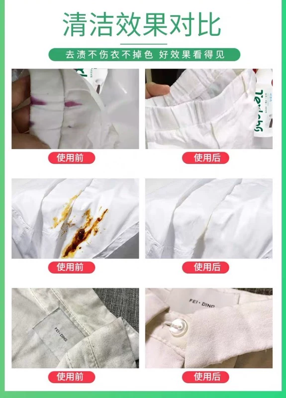 Teksler Cổ áo Khử nhiễm mạnh mẽ và màu vàng và loại bỏ dầu Vết bẩn Quần áo Chăm sóc Khử nhiễm Xịt tốt - Dịch vụ giặt ủi