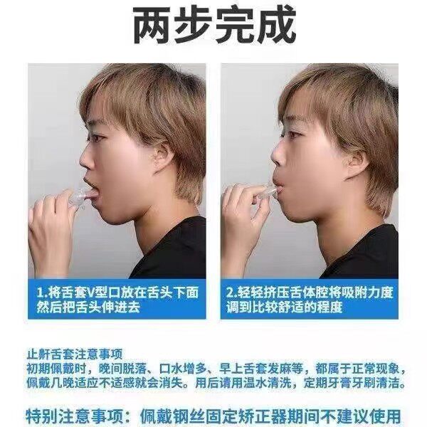 Анти-храп продукты 止鼾舌套防舌根后坠专用口腔矫正器物理防打呼噜止鼾器口舌训练器