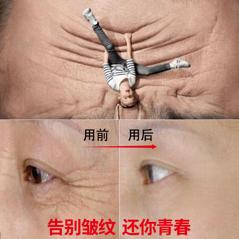 去法令纹去除抬头纹六胜肽鱼尾纹消除颈纹 马油抗皱面霜淡化细纹