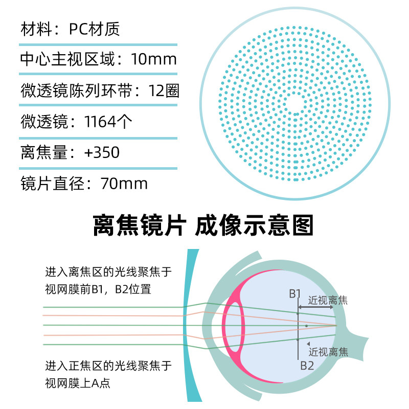 Children's Myopia Multi-Focus Lenses for Myopia Prevention and Control, Peripheral Defocus Lenses to Alleviate the Growth of Children's Myopia