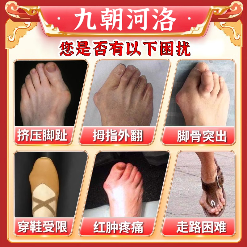 拇外翻神器：拇囊炎疼痛脚趾外翻关节重叠形疼痛特效贴，告别疼痛，重塑美丽足部！-足部按摩走毯-淘宝好物网