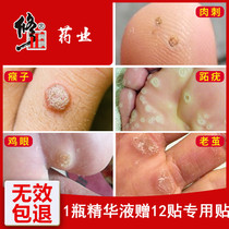 Plantar wart cream Wart scorpion monkey net thorn monkey chicken eye toe meat pelican special medicine for removal of non-stick meat thorn