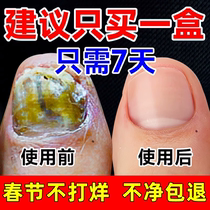 (Tongrentang hot sale) Replace potassium painlessly in 7 days enjoy a good nail life and turn bad nails into good ones drop by drop