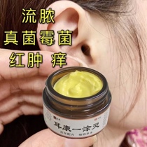 Middle Ear External Ear Canal Membrane Perforation Stop Itching Smoggy Water Flow Pussy Ear Rot Ear Drug Cream Inflammation Care