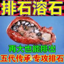 New (no pain drained) Gallstone Lysostone Fossil-based Clay Kidney Stones with Chinese herbal appliqua non-German