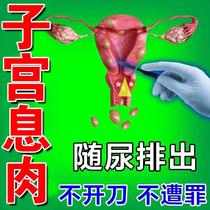 New Uterus Polyps Remove Drug Special Uterine Cavity Endometrial Meatoma Conditioning Intima Thin Thick and Ascending Palace Drooping