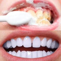 Douyin Super Fire recommended cleaning teeth mousse foam toothpaste whitening teeth to yellow to Zhe breath fresh