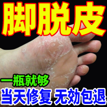 Special cream for peeling soles of soles and peeling soles of soles peeling and peeling cream for rough dry and cracked foot skin to remove calluses and roots