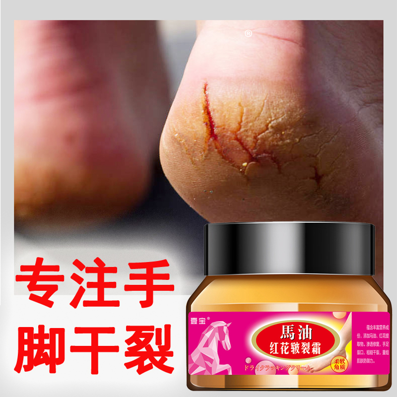 Foot crack cream heel crack guard hand and foot crack dry crack column cracking peeling horse oil crack cream repair cream anti-cracking
