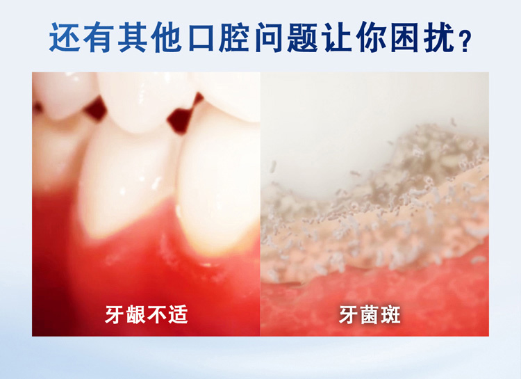 天猫超市 舒适达 抗敏感牙膏套装 多重呵护 100g*3支装 图9