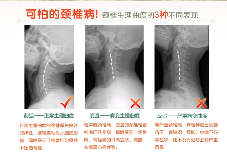 Cũ thô vải kiều mạch vỏ dành cho người lớn gối chăm sóc sức khỏe cổ sửa chữa gối đốt sống cổ tử cung kết hợp gối ngủ gối người lớn gối