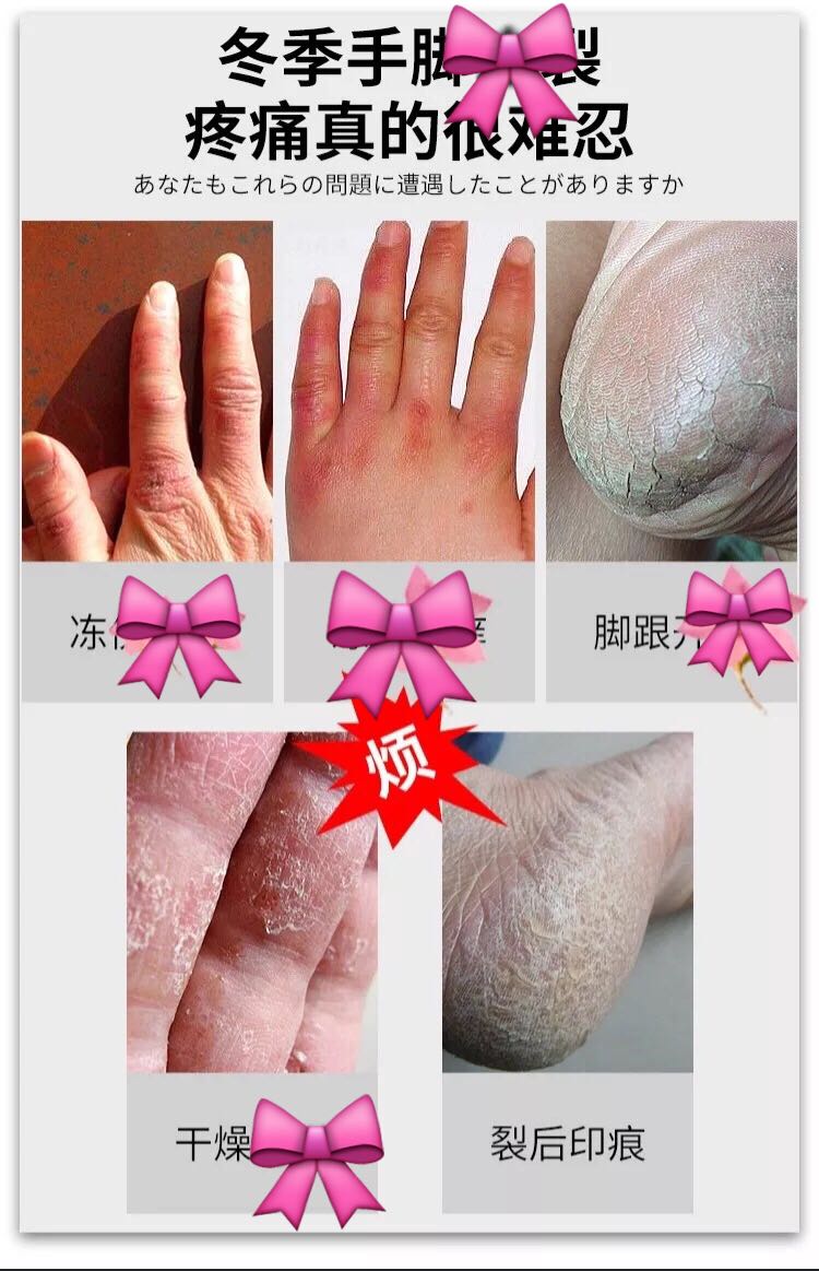 Nhật Bản dầu ngựa rõ ràng kem chân [2 tặng 1] kem chống ngứa kem chăm sóc bàn chân 妍 瑟 清 足 膏 正品 kem trị nứt gót