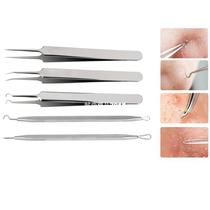 5pcs set Blackhead Pimple Remover Tweezer Blackhead And Come