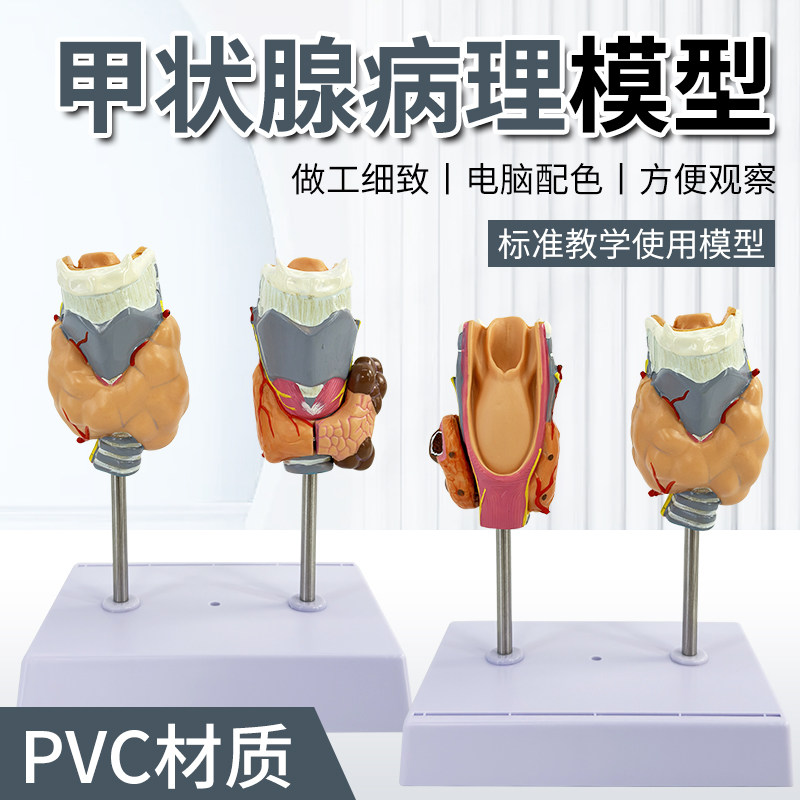 人体病理甲状腺模型甲亢甲低内分泌系统医学解剖甲状腺喉头教具