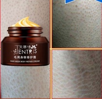 Tiancui Poetry To Goose Pimple Snake Skin Fish Scale Skin Hair Circumferential Cream Body Milk Mao Zhou Repair Cream