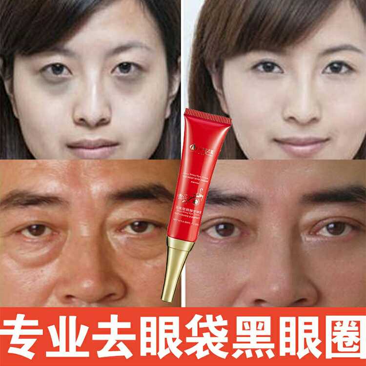 Qianzi Rose Lustrous Repair Eye Cream Removes Dark Circles Eye Bags Puffy Fat Particles Eye Lines Hydrating And Firming Eye Cream