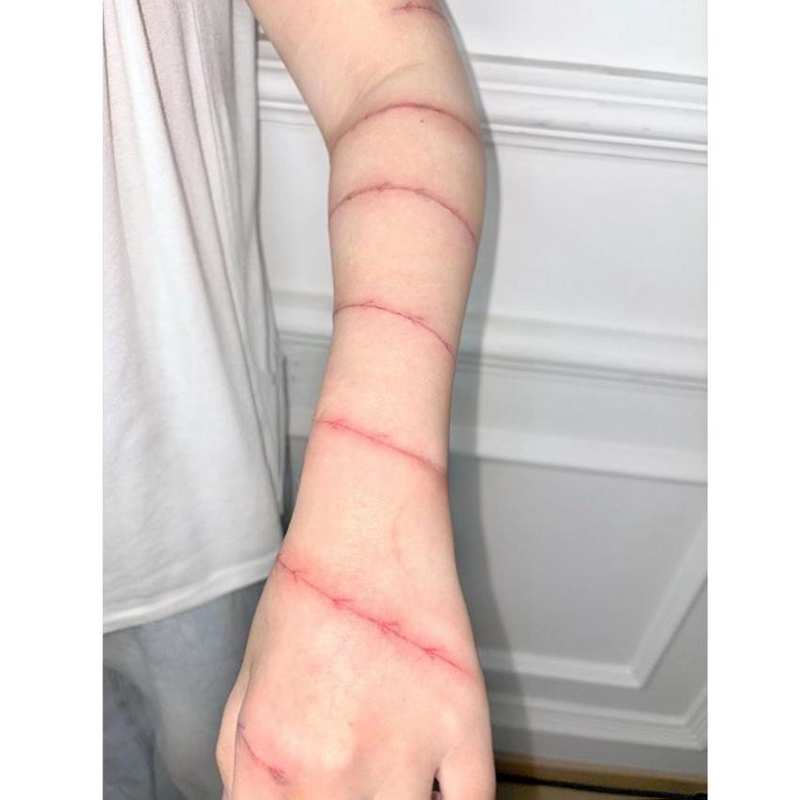 Whip Mark Simulation Scar Tattoo Stickers, Injury Makeup Bruise Tattoo Stickers for Women, Waterproof Arm Student Style Whip Mark Simulation Scar Tattoo Stickers, Injury Makeup Bruise Tattoo Stickers for Women, Waterproof Arm Student Style