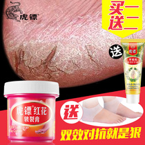 Foot cream foot cream cracked feet a touch to restore tenderness wipe feet and feet anti-chapping moisturizing moisturizing womens foot care