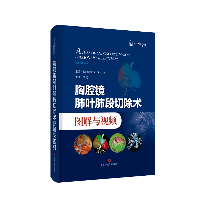 Основной перевод thoracoscopy pulmonary lobe segmentation and video high -text Введение в техническую операцию виде thoracoscopic pulmonary lobe and pulmonary section resection Статическое изображение видео Shanghai Science and Technology Publishing 9787547863039