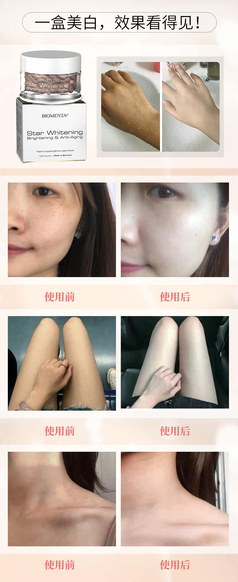 790 Рекомендация отбеливания .jpg