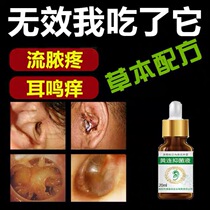 Tinnitus effective medicine middle ear inflamed Streetto ear fluid people with ears anti-inflammatory and perforated itchy ear shampoo ointment