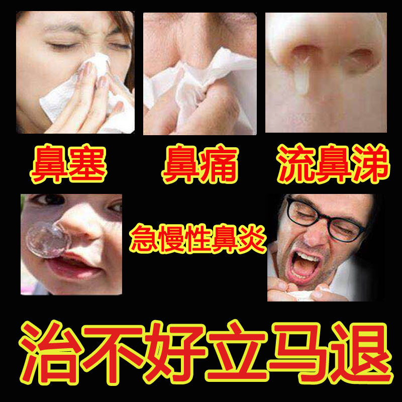 Bishutong treatment of rhinitis spray nasal congestion nasal itching nasal mucus sinusitis turbinate hypertrophy allergic rhinitis Japanese ventilation - Taobao