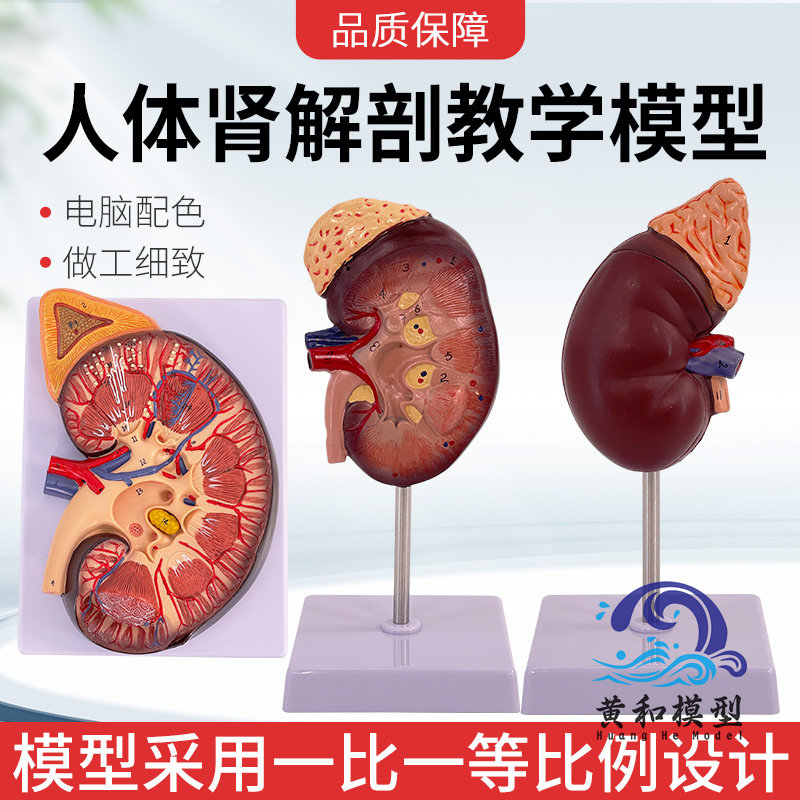 人体肾脏模型 肾解剖附肾上腺放大模型病变肾脏 人体内脏器官解剖