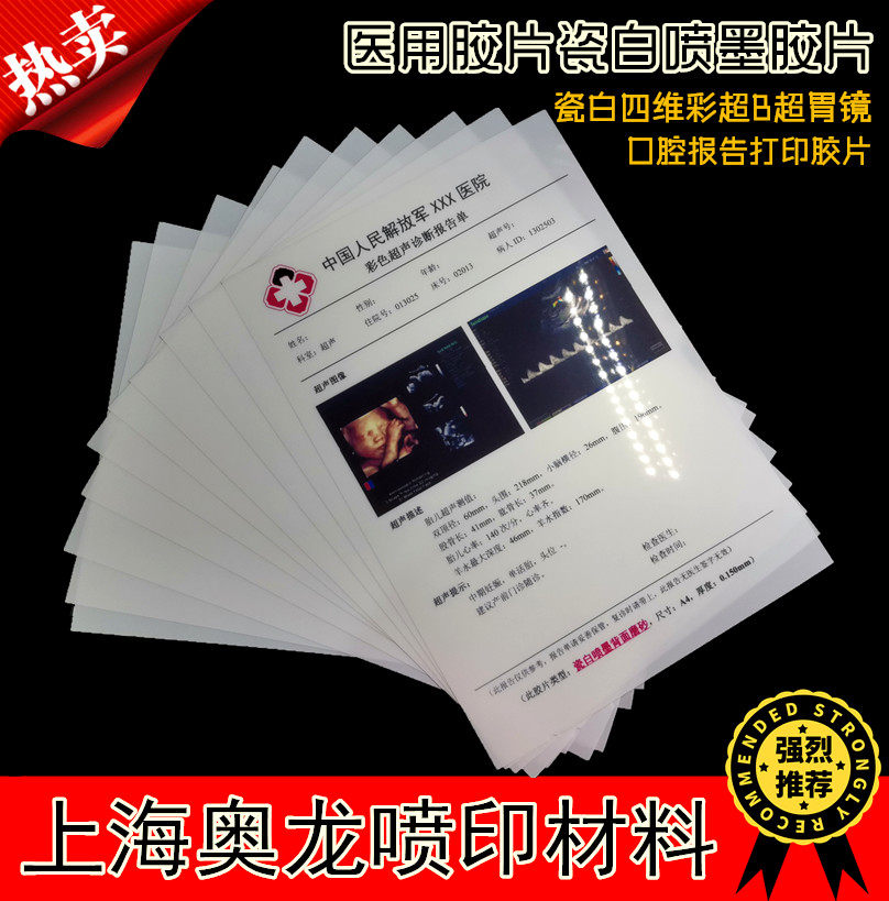 Hospital with negatives porcelain white inkjet sheet medical negatives A4 negatives stomach mirror B superfour dimensional color overshadow print paper 