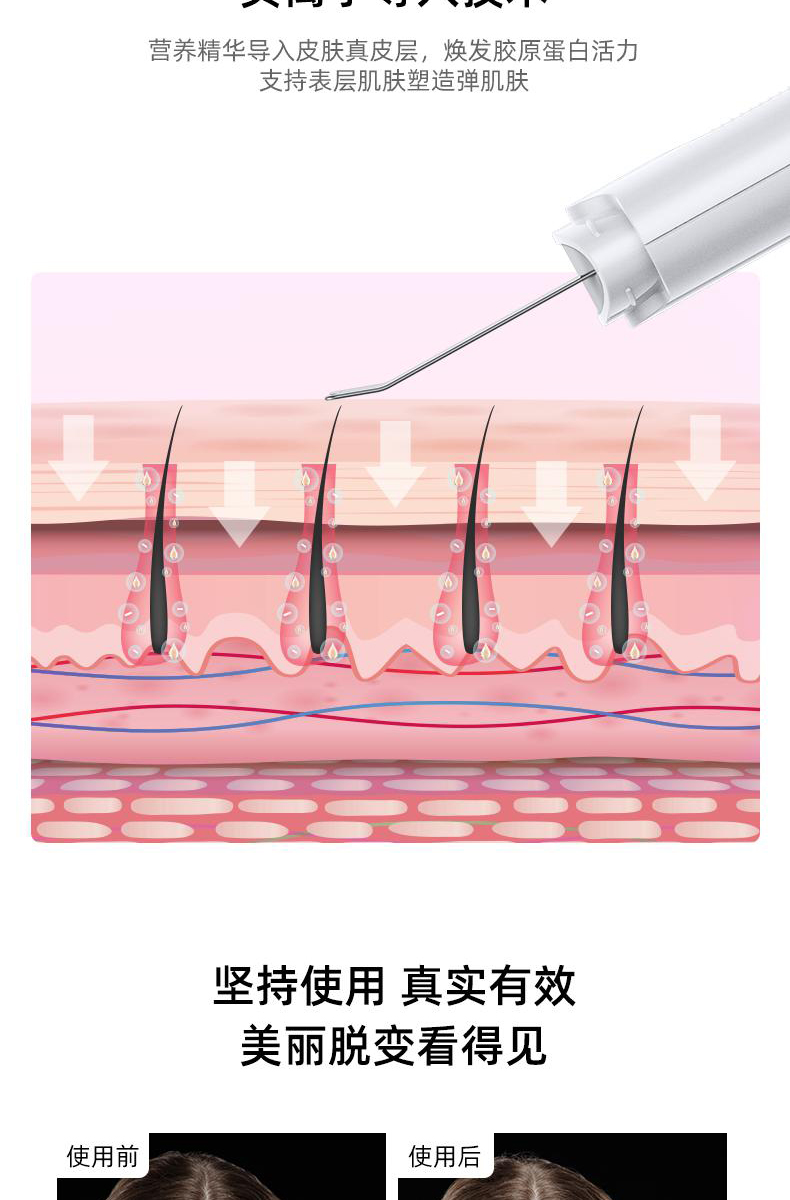 【中国直邮】黄圣依同款 OES 超声波离子清洁仪吸黑头神器脸部导入美容仪  白色