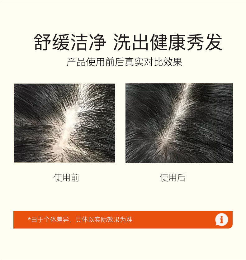 AolaKD 生姜去屑固发洗发水 350ml 图2
