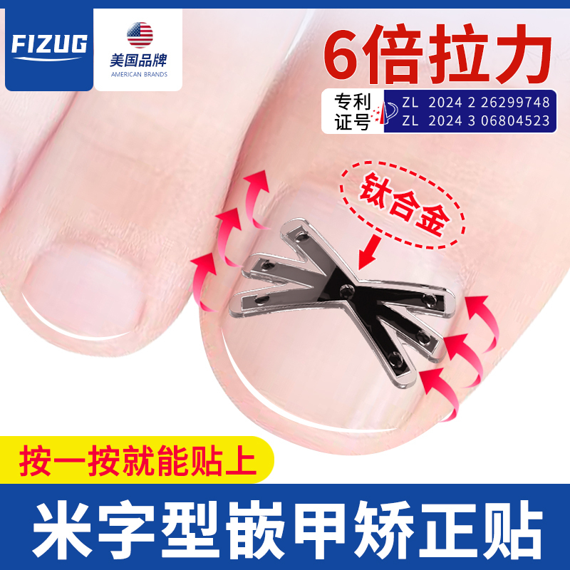 American Fizug Ingrown Toenail Corrector, Nail Patch for Toenails Growing into the Flesh, Special Tool for Correcting Ingrown Toenails American Fizug Ingrown Toenail Corrector, Nail Patch for Toenails Growing into the Flesh, Special Tool for Correcting Ingrown Toenails