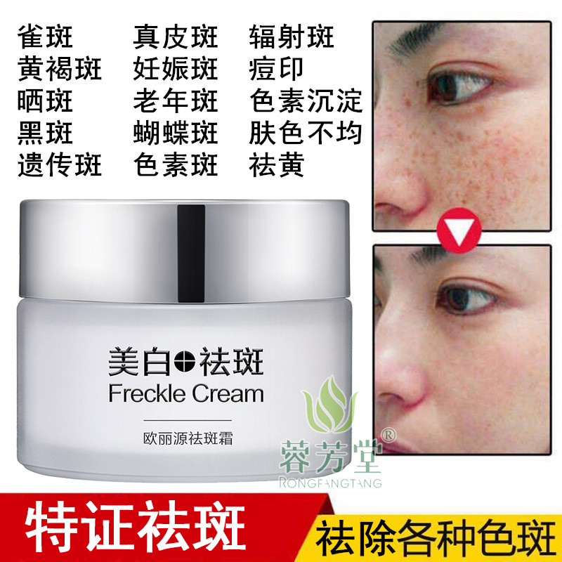 Quanxi Ou Liyuan Dispel Spot Cream To Yellow Brown Spotted with Senile Plaque Powerful Protein God Gestational Butterfly Whitening