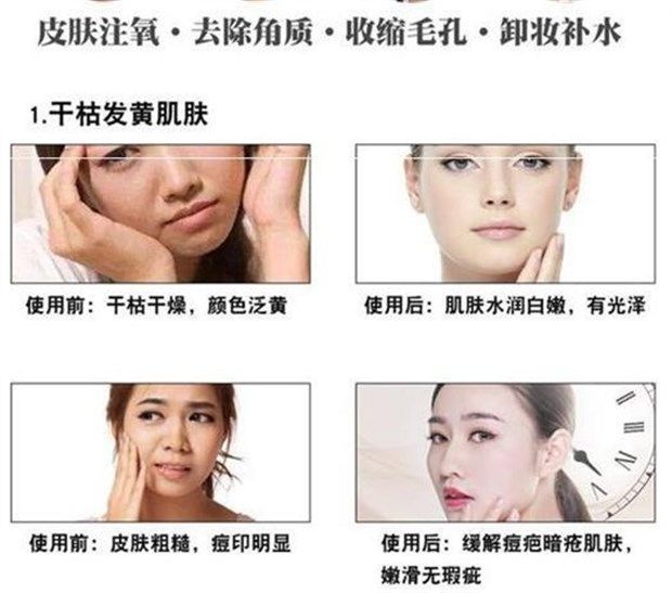 Làm sạch trẻ hóa, làm sạch sâu, làm sạch lỗ chân lông, kem massage sống, kem dưỡng da mặt chính hãng - Kem massage mặt kem massage mặt nâng cơ