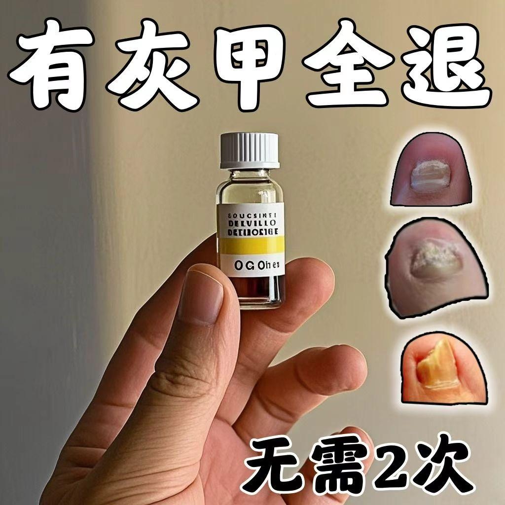 25年必买!日本亮甲灰趾甲增厚专用液药膏|重度厚甲救星?真实测评避坑指南-指甲修护乳-淘宝好物网