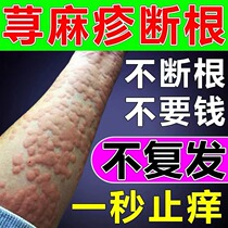 Eliminate urticaria allergy relieve itching and eradication remove cholinergic properties treat acute and chronic urticaria root ointment