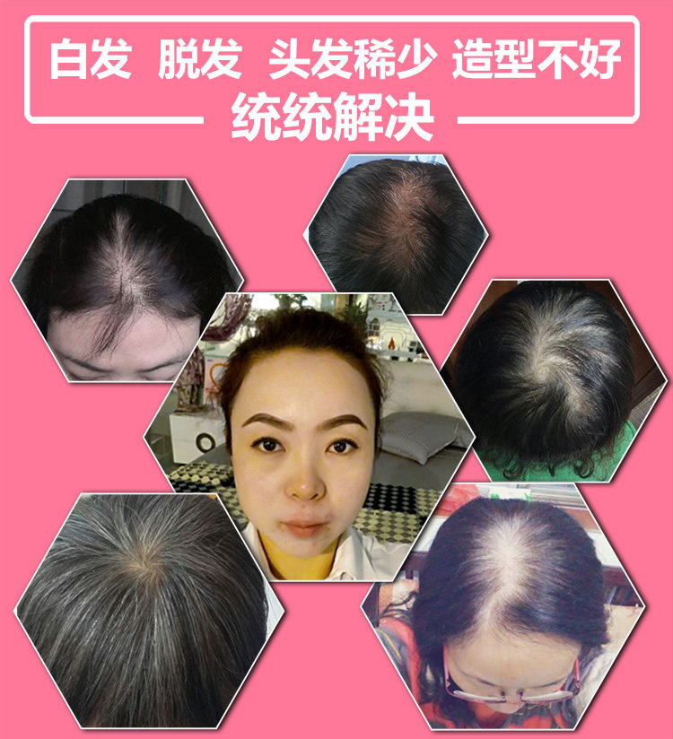 Extension cheveux - Ref 226364 Image 7