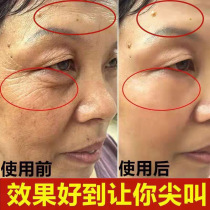 Anti-wrinkle firming anti-aging whitening lightening fine lines removing dark circles eye bags fish tail looking up eye corner lines six-polypeptide liquid