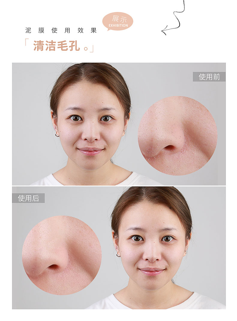 BIGEVE Zhang Dawei Like New Muscle Clay Mask Moisturising Oil Control Cleansing Skin Pore Exfoliating Mask - Mặt nạ mặt nạ lô hội