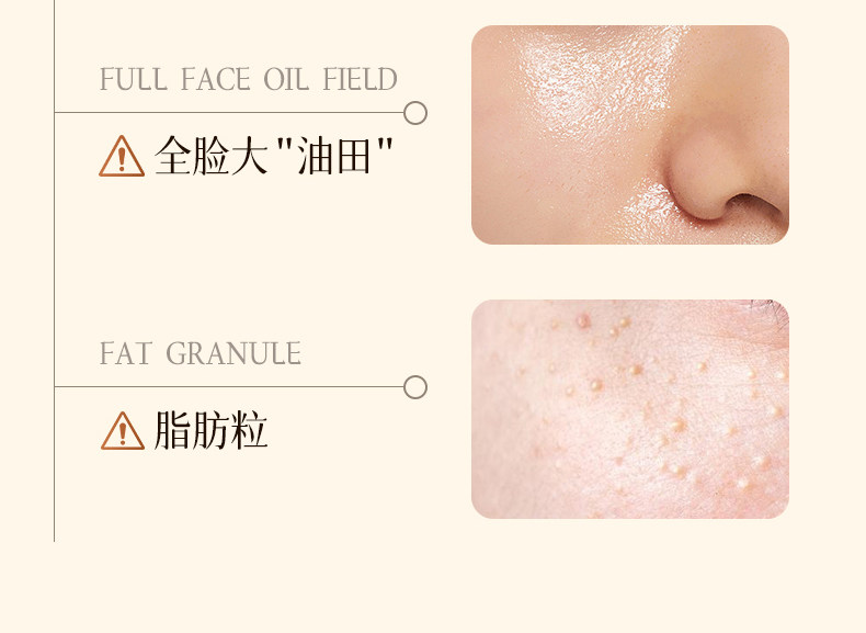 【中國直郵】 康佳 吸黑頭神器 美容儀家用臉部小氣泡黑頭毛孔清潔吸出