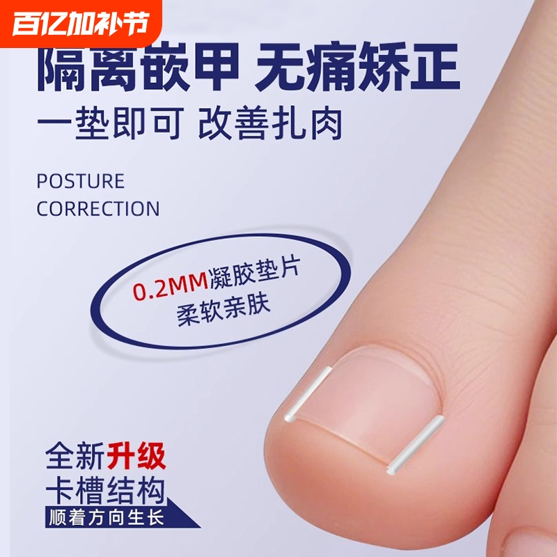 Ingrown Toenail Corrector, a Tool for Correcting Nails That Grow into the Flesh, Isolation and Filling Pads for Big Toe Nails That Grow into the Flesh