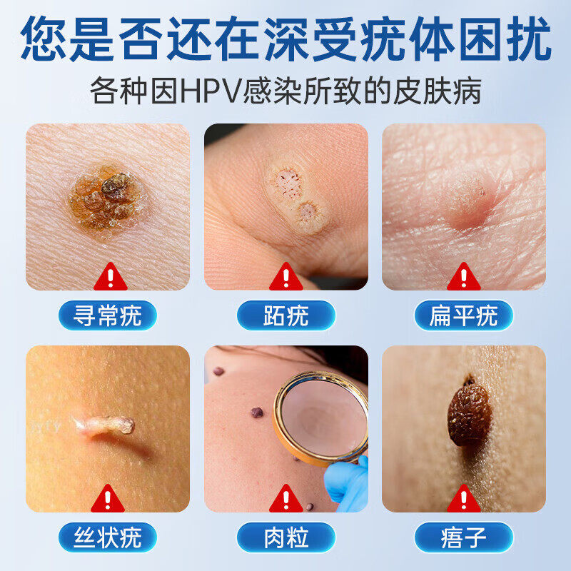 祛尤膏:告别恼人瘊子,重塑光滑肌肤!💪 -身体磨砂膏-淘宝百科网
