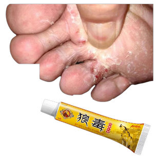 狼毒软膏正品抑菌奇草乳膏去气脚专用水泡皮肤止痒膏脚丫子痒烂脚