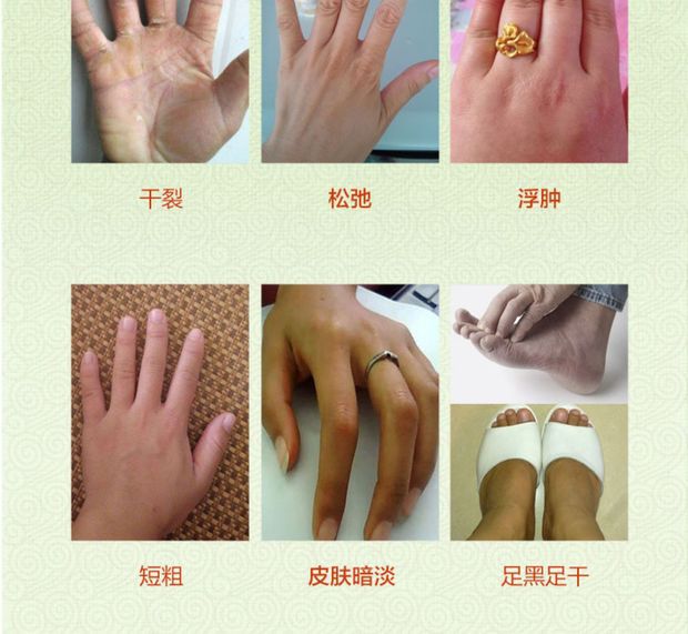 [Mua 2 tặng 1] Lắc cùng một đoạn tinh dầu mỏng và dài tinh dầu làm trắng da làm mềm da giữ ẩm cho da - Tinh dầu điều trị dau que