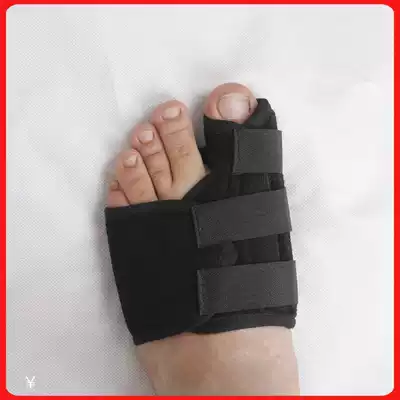 Enhanced thumb valgus orthotics, thumb, toe, orthopedic orientation, overlap, toe, Big Foot