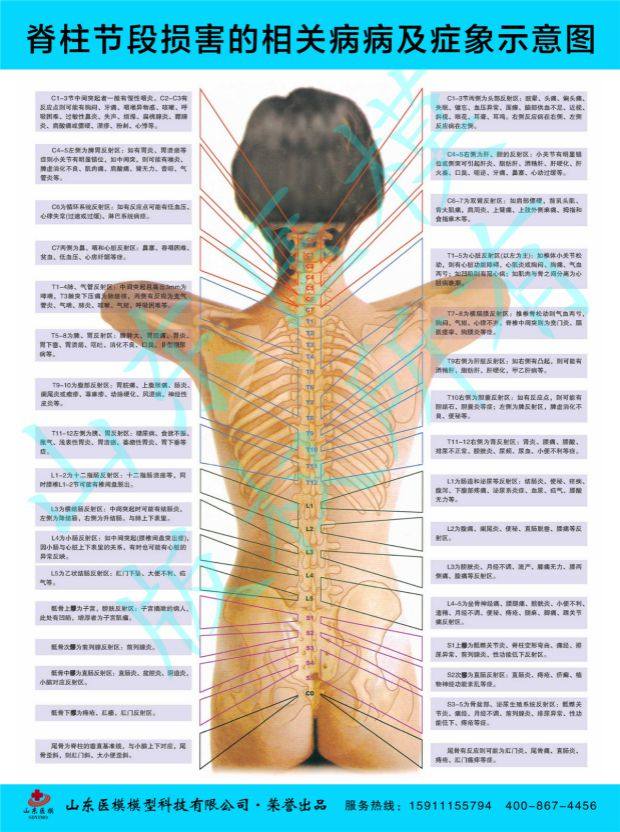 Column wall chart Column disease poster Schematic wall chart of the related diseases and symptoms of segmental damage