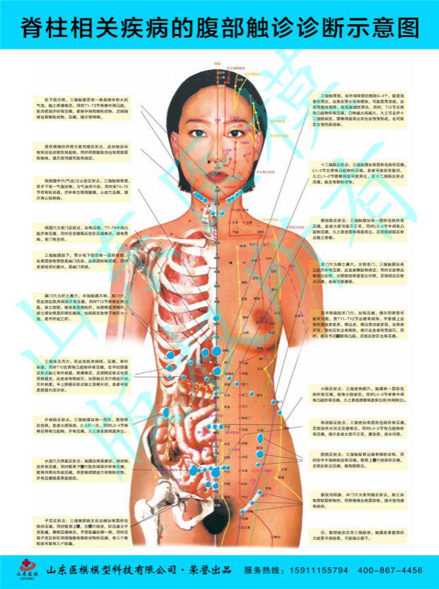 脊柱挂图医院医学挂图 脊柱相关疾病的腹部触诊诊断示意图