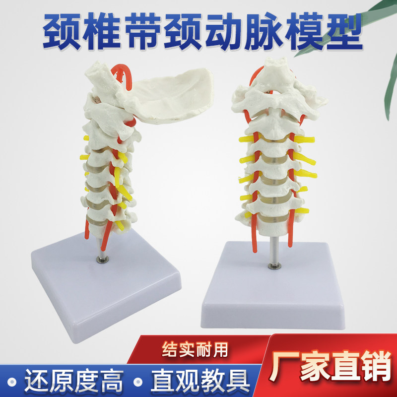 自然大人体颈椎带颈动脉后枕骨椎间盘与神经骨科模型 颈椎 枕骨