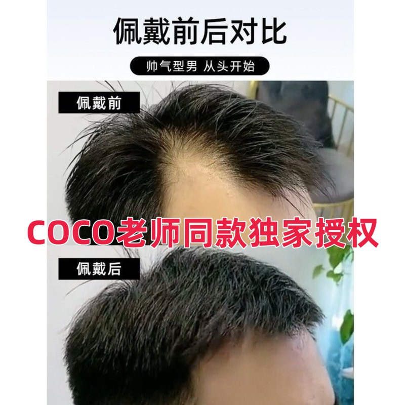 Men's Wig Hairline Patch, Exclusively Authorized by Coco Teacher, Genuine Cmc! M-Shaped Hairline