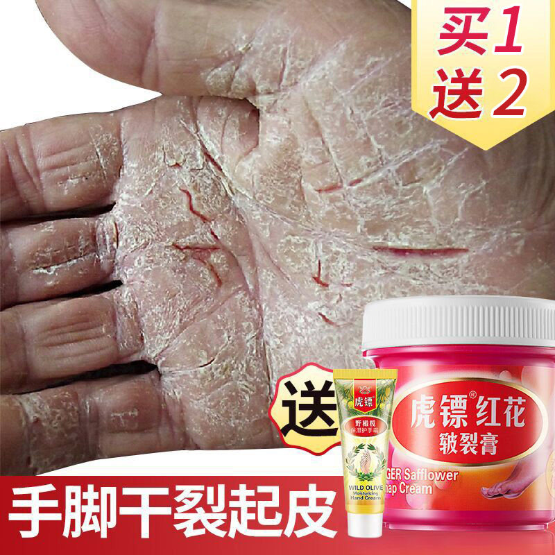 Hands and feet crack hand foot dry cracked repairing anti-crack protective hand cream healing cream Fingers Peeling dry Cracked Horse Oil