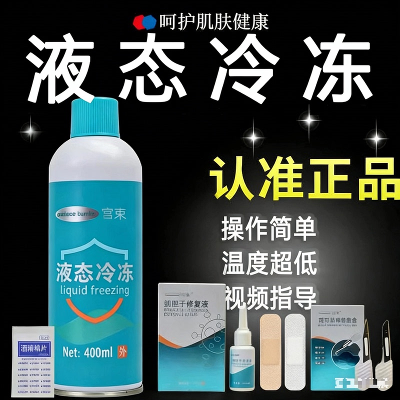 Liquid Freezing Solution Small Bottle for Home Use, Medical-Grade Removal Tool, Freezing Agent Liquid, Non-Liquid Nitrogen Freezing Cooling Spray Liquid Freezing Solution Small Bottle for Home Use, Medical-Grade Removal Tool, Freezing Agent Liquid, Non-Liquid Nitrogen Freezing Cooling Spray